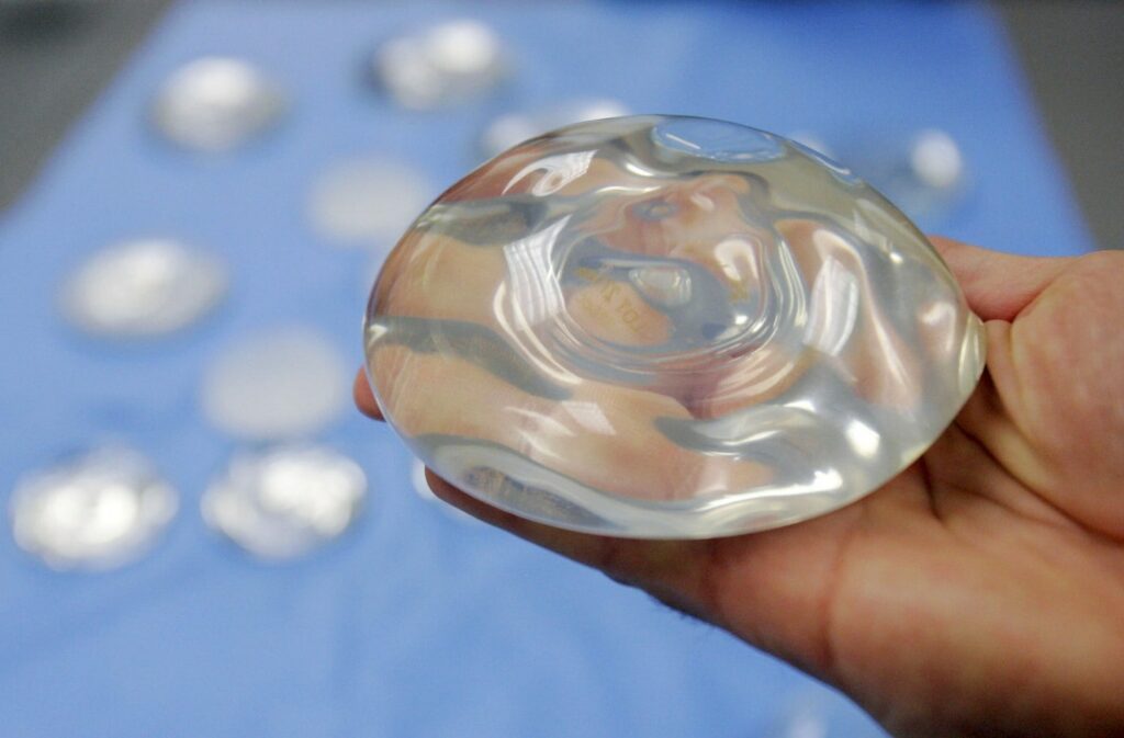 breast implant toxicity